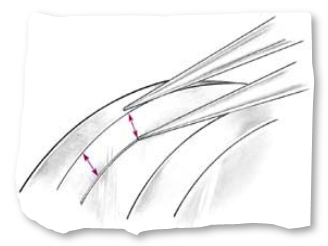 Channel Baguette Measurement